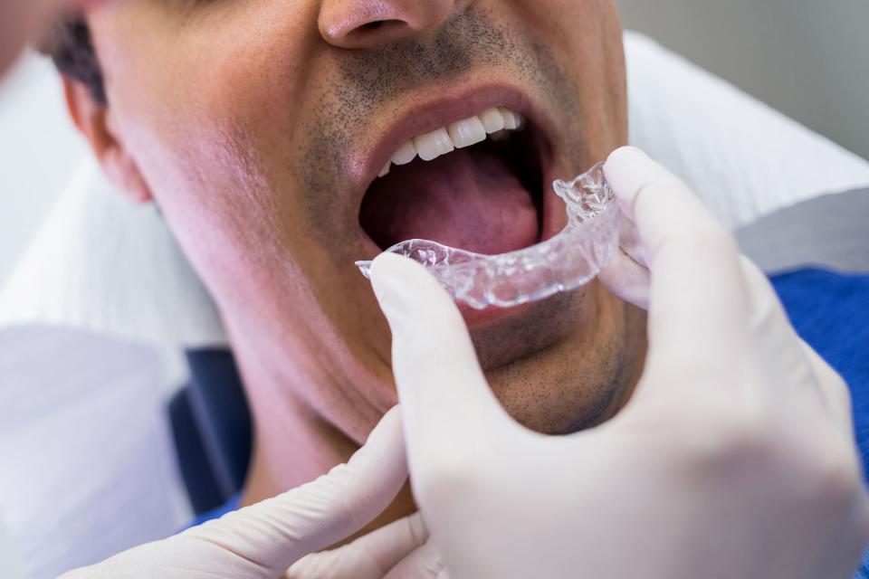 Dispositivi personalizzati