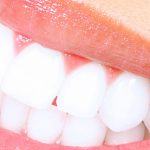 ESTETICA DENTALE a Bergamo e Azzano san Paolo