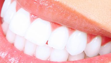 ESTETICA DENTALE a Bergamo e Azzano san Paolo