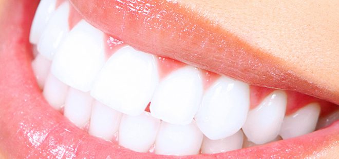 ESTETICA DENTALE a Bergamo e Azzano san Paolo