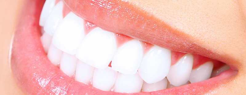 ESTETICA DENTALE a Bergamo e Azzano san Paolo