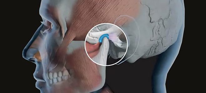 Disturbi della mandibola: dolori articolari, click, affaticamento muscolare