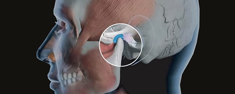 Disturbi della mandibola: dolori articolari, click, affaticamento muscolare