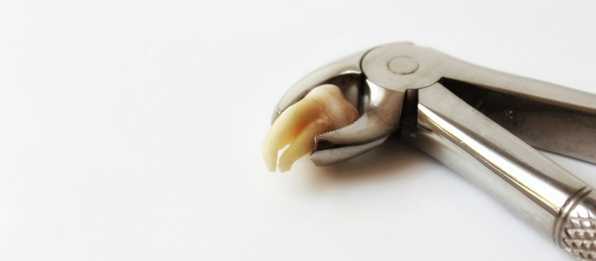Dente del giudizio: un mostro con ancora tanti tabù