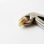 Dente del giudizio: un mostro con ancora tanti tabù