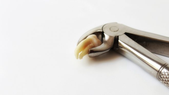 Dente del giudizio: un mostro con ancora tanti tabù
