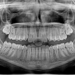 RADIOLOGIA a Bergamo e Azzano san Paolo
