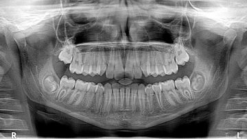 RADIOLOGIA a Bergamo e Azzano san Paolo
