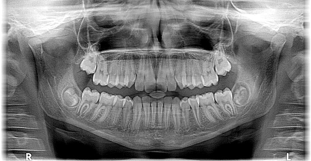 RADIOLOGIA a Bergamo e Azzano san Paolo